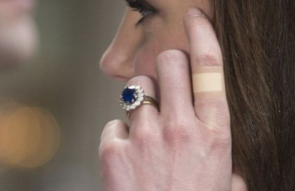 <br />
«Вечный» пластырь на пальцах Кейт Миддлтон озадачил поклонников<br />
